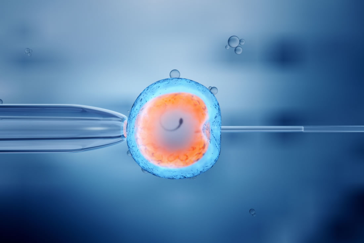 O que &eacute; a FIV (fertiliza&ccedil;&atilde;o in vitro)?